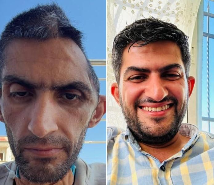 نادي الأسير: حالة الصحفي مجاهد بني مفلح تختزل حقيقة السجن الإبادي الإسرائيلي
