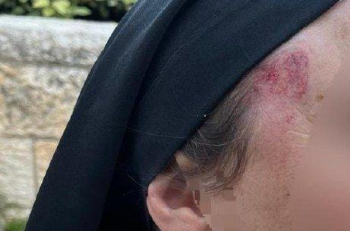 إصابة راهبة جراء اعتداء مستوطن عليها في القدس