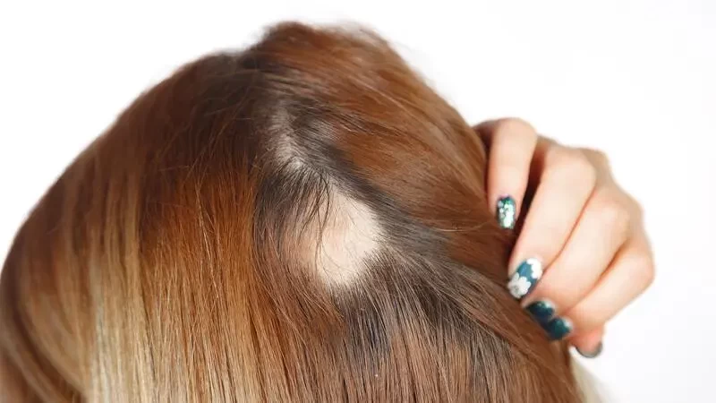 تفسير الاحلام