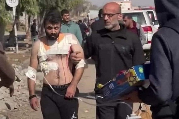 جرحى غزة .. نزوح دامٍ وعلاج غير متوفر