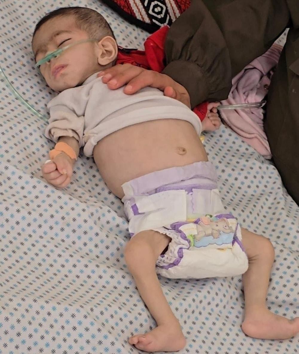 ارتفاع وفيات المجاعة إلى 450