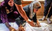 AA-20240907-35586734-35586727-ISRAELI_ARMY_ATTACKS_CONTINUE_ON_THE_GAZA_STRIP.jpg-dfe50cf0-3083-4365-9e42-0987a38729dc.jpg