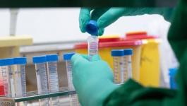 الصحة العالمية تكشف عن موعد تطوير لقاح فيروس كورونا