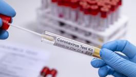 تجارب على فيروس كورونا
