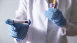 الجزائر تعلن تعافي أول حالة مصابة بفيروس 