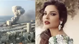 نادين نسيب نجيم ترد على اتهامها بادعاء الإصابة في انفجار مرفأ بيروت