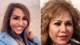 مها المصري ضحية عمليات التجميل الفاشلة مُجددًا!