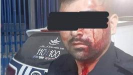 الاحتلال ينظر اليوم بتمديد اعتقال شابيْن تصديا للشرطة الإسرائيلية في كفر قاسم