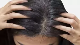 الشعر الابيض