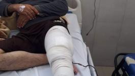 تقارير: مواطن من غزّة يُطالب كافة الجهات المسؤولة بتسهيل سفره للعلاج لتفادي بتر قدمه
