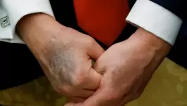 ترامب