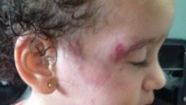 صورة الطفلة شام