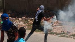 إصابة العشرات جراء قمع الاحتلال لمسيرة كفر قدوم الأسبوعية