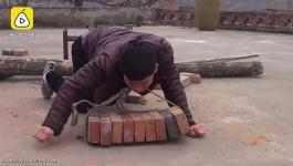  شاب صيني يساعد عائلته بعمل شاق ..رغم حالته الصحية الصعبة