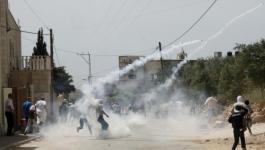 إصابات بالاختناق بغاز الاحتلال