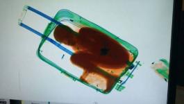 طفل يختنق داخل حقيبة 