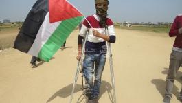 بتر أطراف جريحين من غزة رفضت سلطات الاحتلال علاجهما بالضفة