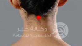 فينج فو