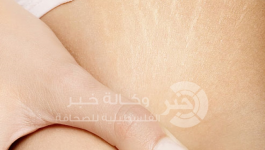 الخطوط البيضاء