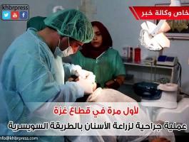 لأول مرة في قطاع غزة .. طبيب يجري عملية جراحة أسنان فورية خلال جلسة واحدة