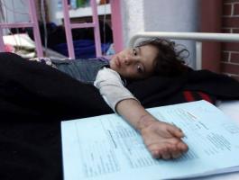 ارتفاع وفيات الدفتيريا في اليمن إلى 53 حالة