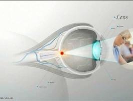 الاستحمام بالعدسات اللاصقة قد يتسبب بفقدان النظر