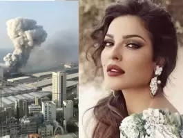 نادين نسيب نجيم ترد على اتهامها بادعاء الإصابة في انفجار مرفأ بيروت