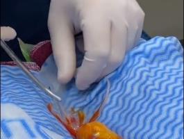 عملية جراحية لسمكة ذهبية بأستراليا لإزالة ورم يحظى بملايين المشاهدات