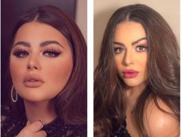 هنادي مهنا تلفت الأنظار بنحافتها الشديدة