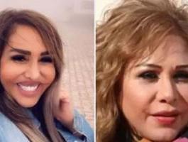 مها المصري ضحية عمليات التجميل الفاشلة مُجددًا!