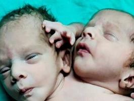 طفل براسين و3 اذرع وقلبين