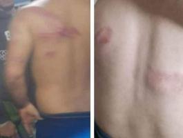 اختطاف 3 عمال فلسطينيين بالجليل