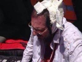 العبري يزعم إصابة 10 مستوطنين جراء رشقهم بالحجارة في نابلس