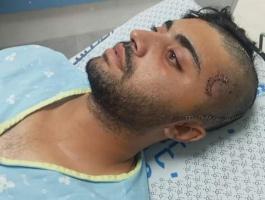 بالصور: الاحتلال يفرج عن صياد مصاب من قطاع غزة
