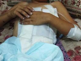 عائلة الطفل عبد الكريم السري تُناشد بسرعة إجلاء نجلها للعلاج في الخارج