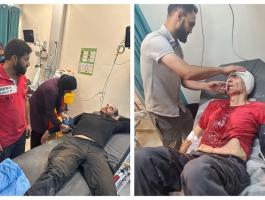 إصابات في اعتداء للمستعمرين في بلدة بيتا