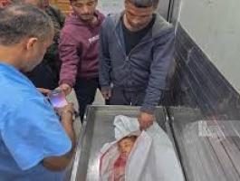 تنزيل (20).jpeg