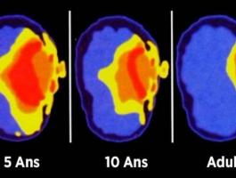 voici-ce-que-font-les-smartphones-sur-le-cerveau-des-enfants-jpg-64406164366508817