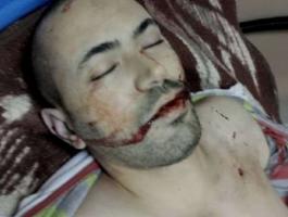 المحامية عطية تؤكد وجود دلائل موثقة على إعدام الاحتلال للشهيد الصالحي