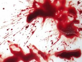 لماذا نخاف من منظر الدم؟