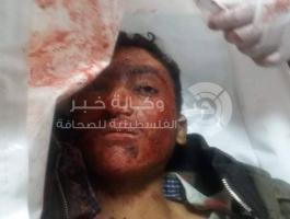 كيف جر جنود الاحتلال ولدًا في الثامنة لأكثر من ساعة في الخليل؟.jpg