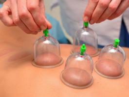 cupping-benefits-jpg-11175610220924331.jpg