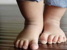 flat-feet-in-children-may-need-attention1-980x490