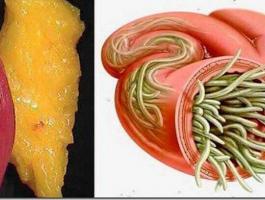 evacuez-toute-la-graisse-et-les-parasites-presents-dans-votre-corps-grace-a-cette-astuce-puissante-jpg-51516226224109009.jpg
