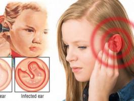 earinfection-728x387-jpg-7660520608401205