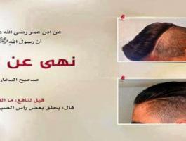 لماذا نهى رسول الله -صلى الله عليه وسلم- عن القزع؟