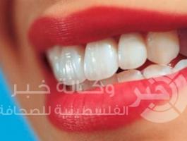 تسوس الأسنان