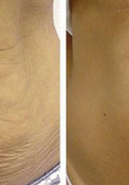 untitled-png-52238035654191826