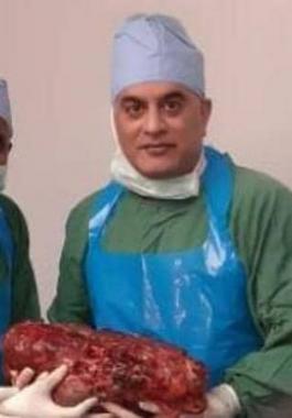 الهند  