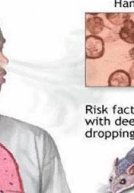 فيروس هانتا